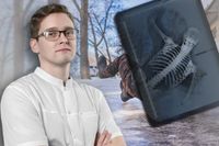 От больших синяков до серьезных переломов со смещением: врач-травматолог назвал самые популярные травмы в гололед