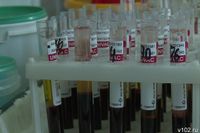 Почти 121 тыс. волгоградцев проверили на гепатит С