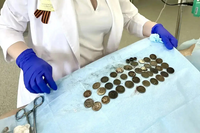 Врачи достали из волгоградца 214 монет, 11 гаек и дверные петли