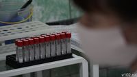 Пройти обследование на ВИЧ санврачи призывают волгоградцев