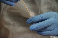 Медики напомнили волгоградцам об опасности клещевого энцефалита