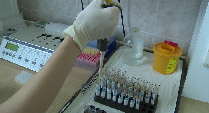 Три вида вирусов выявляют лаборатории у жителей Волгоградской области