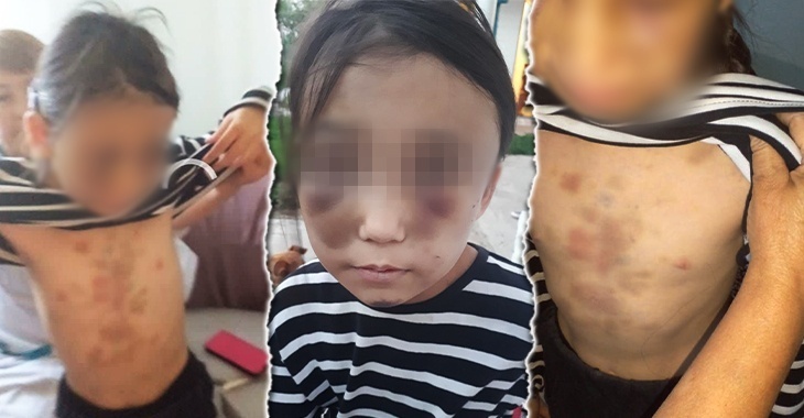 «Ходила в школу в синяках»: новые подробности избиения 8-летней девочки под Волгоградом